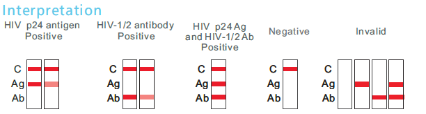 HIV 4th Generation interpretation
